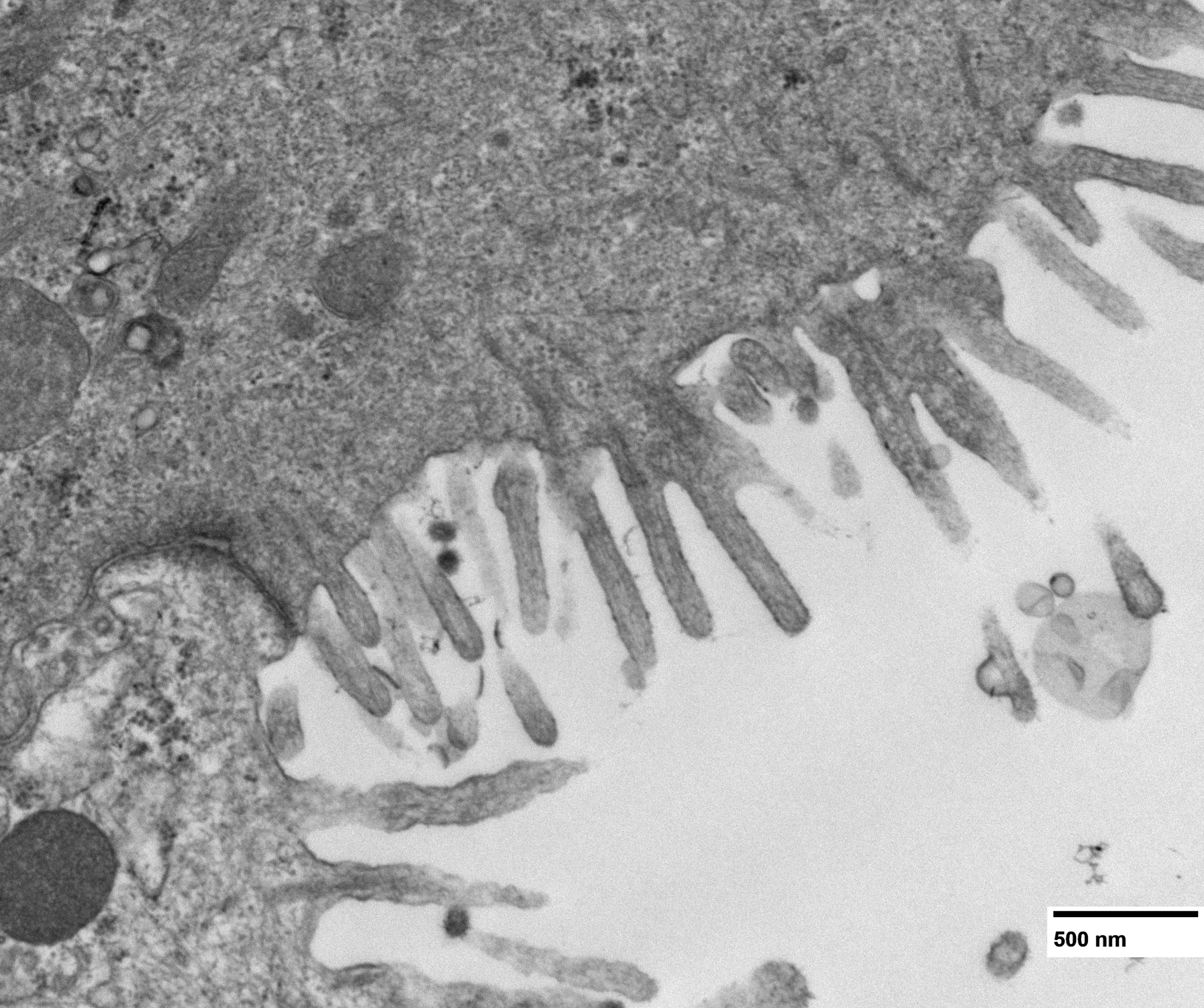 Organoids as a model to study viral infection