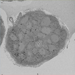 Serial images in high resolution scanning electron microscope
